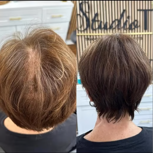 🔥Only $19.99 Last Day 💥Breathable Natural Hair Tips for Women with Thinning Hair