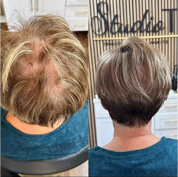 🔥Only $19.99 Last Day 💥Breathable Natural Hair Tips for Women with Thinning Hair