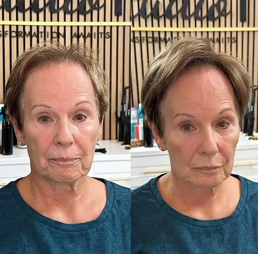 🔥Only $19.99 Last Day 💥Breathable Natural Hair Tips for Women with Thinning Hair